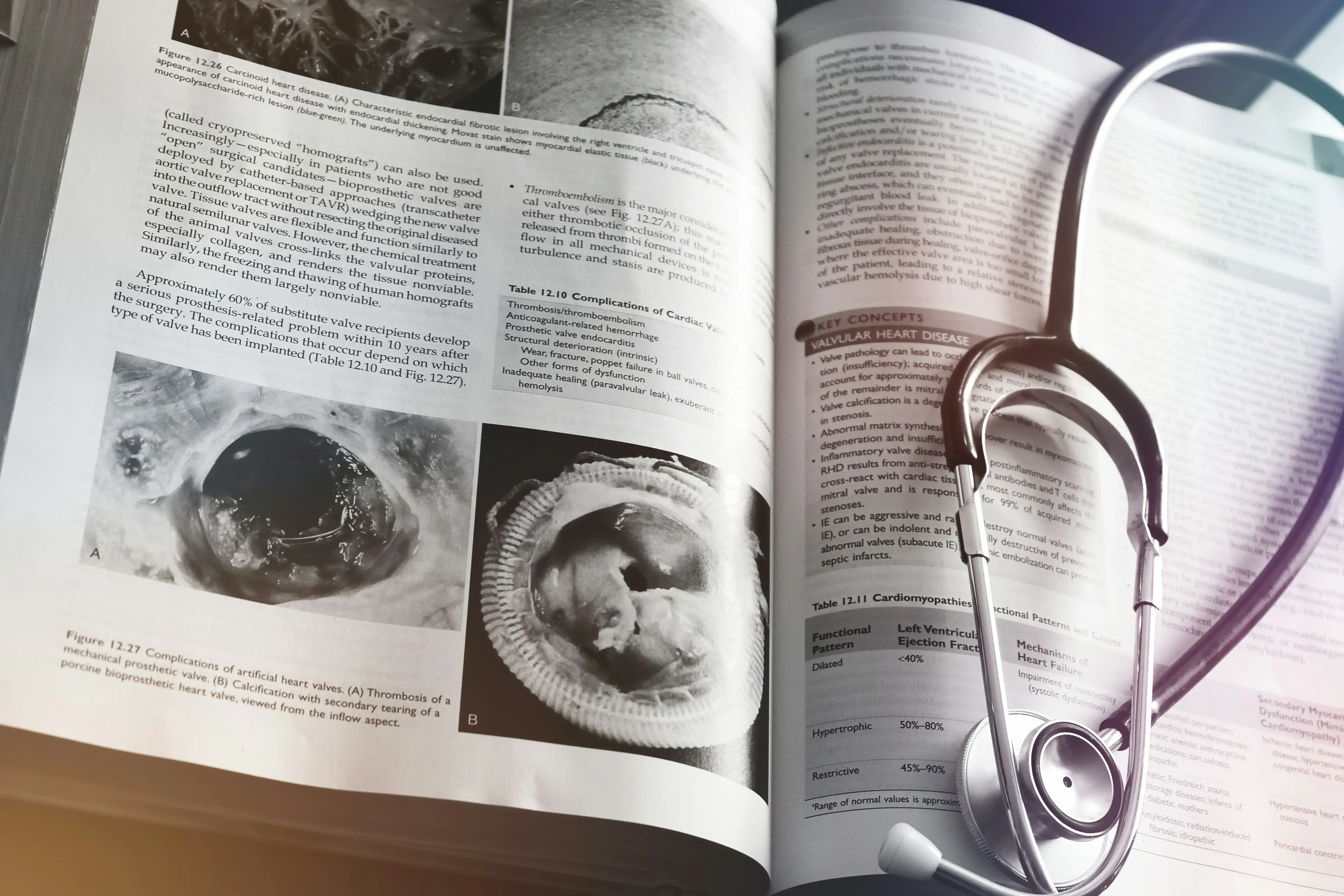 MBBS in Georgia